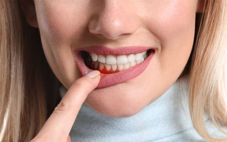 Defeating Gum Disease: Prevention, Treatment, and Your Oral Health 1 6 Defeating Gum Disease Prevention Treatment and Your Oral Health