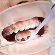 Emergency Dentistry: Handling Orthodontic Crises and More