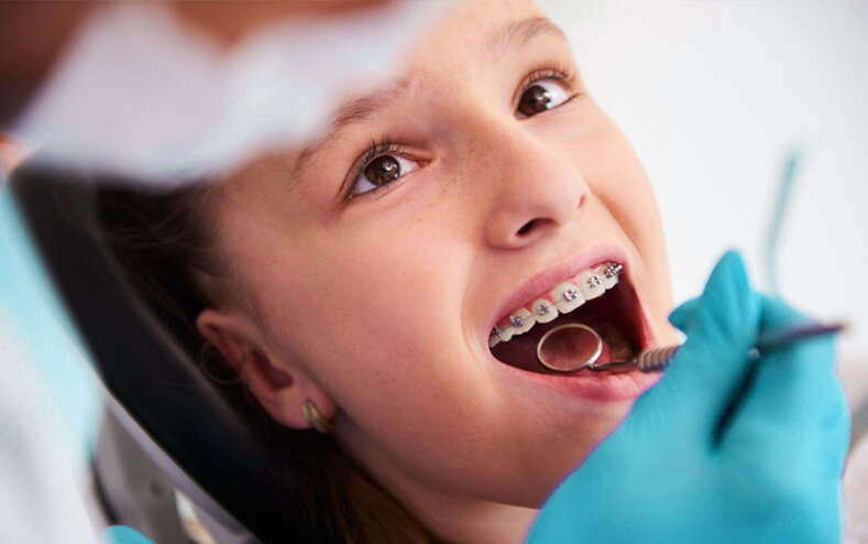 children orthodontics