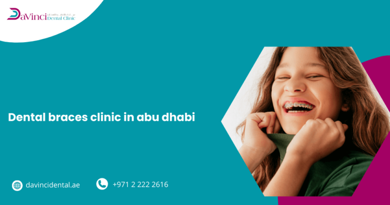 Dental Braces Clinic in Abu Dhabi