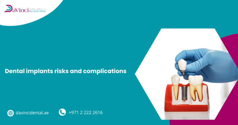 Dental Implants Risks and Complications