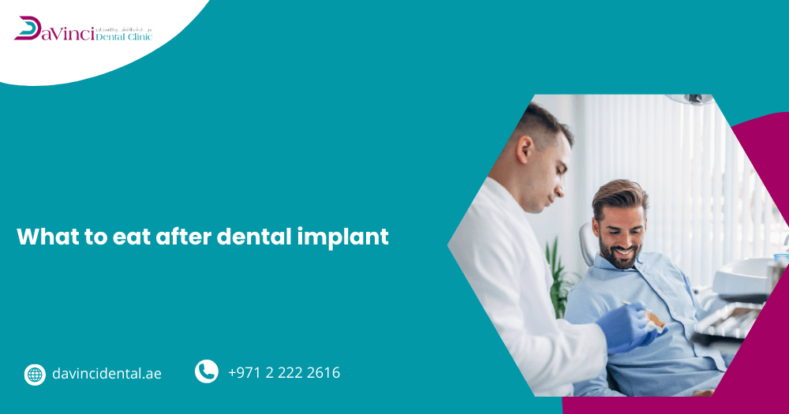 What To Eat After Dental Implants