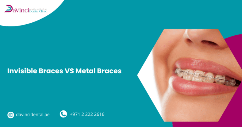 Invisible Braces vs Metal Braces
