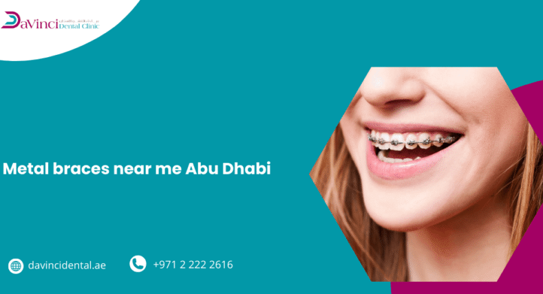 Metal Braces Near Me Abu Dhabi