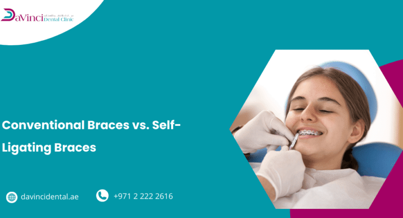 Conventional Braces vs. Self-Ligating Braces