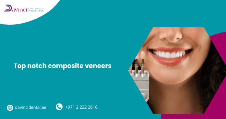 Top-Notch Composite Veneers