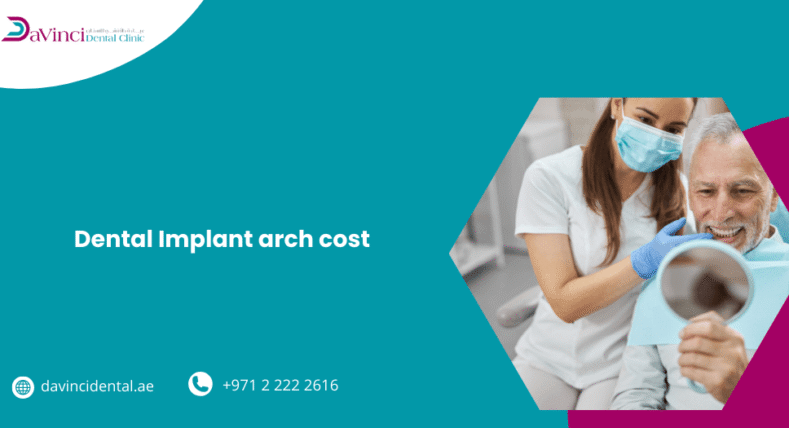 Dental Implant Arch Cost