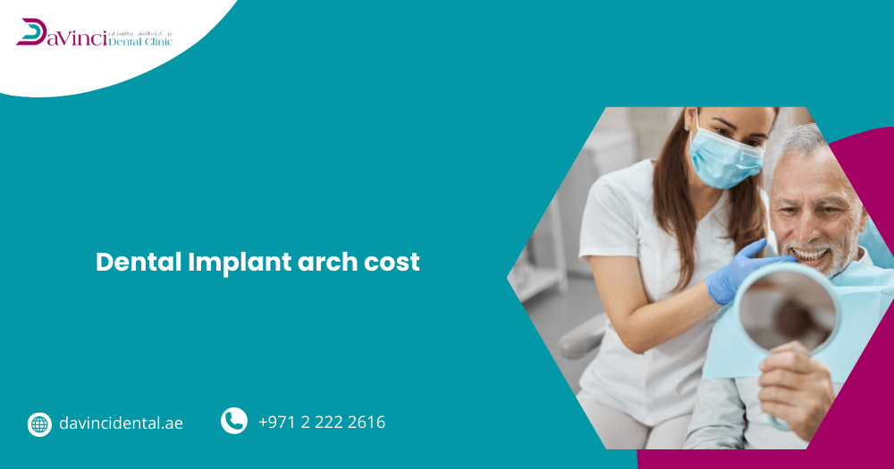 Dental Implant Arch Cost