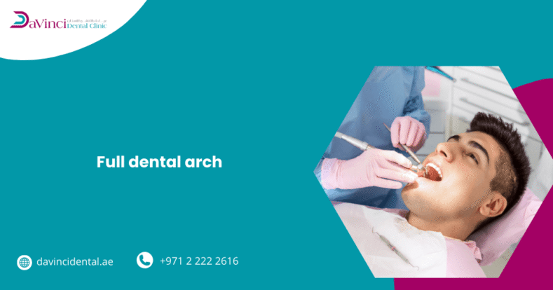 Full Dental Arch