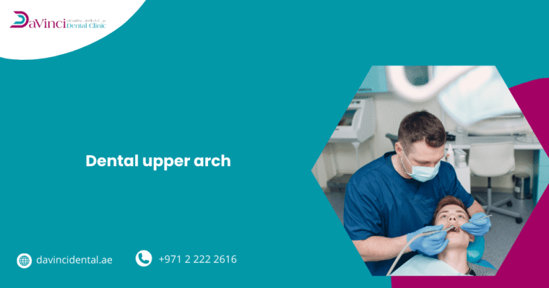 Upper Arch Implants
