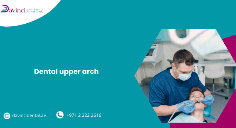 Upper Arch Implants