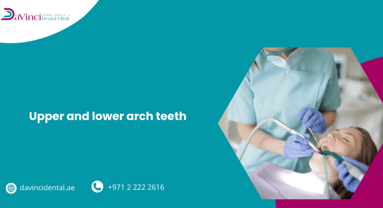 Upper and Lower Arch Teeth