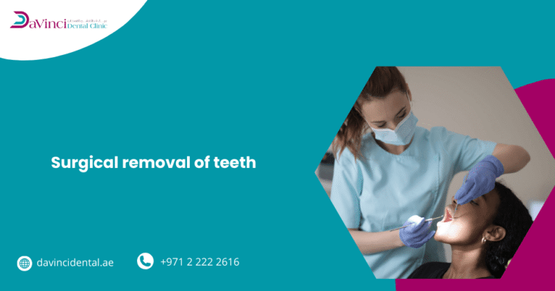 surgical removal of teeth