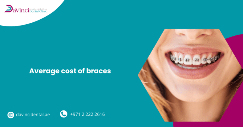 Average Cost of Braces