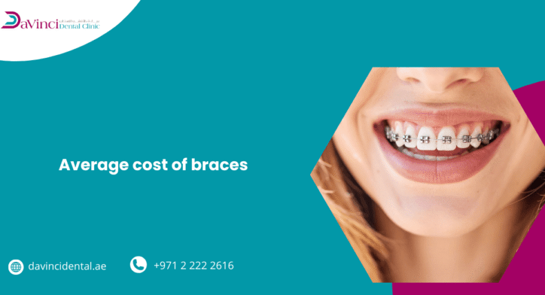 Average Cost of Braces