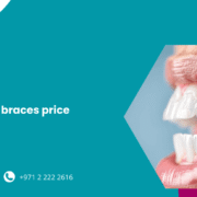 Everything You Need to Know About Clear Braces Price In Abu Dhabi