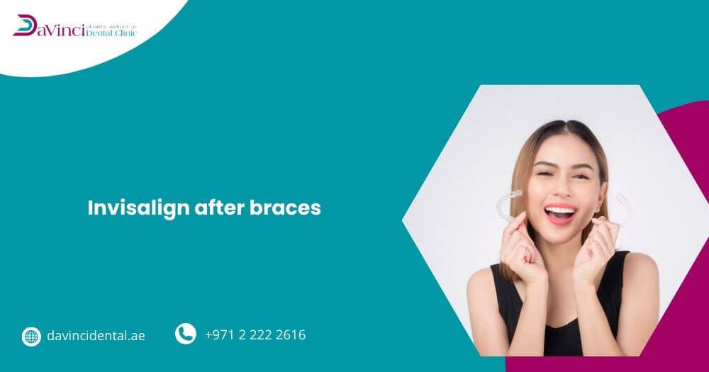 Invisalign After Braces