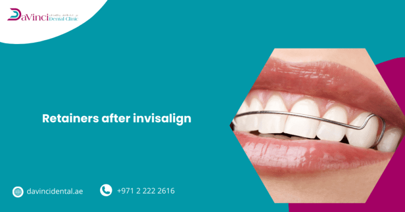 Retainers After Invisalign