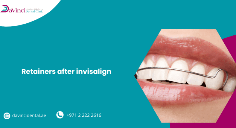 Retainers After Invisalign