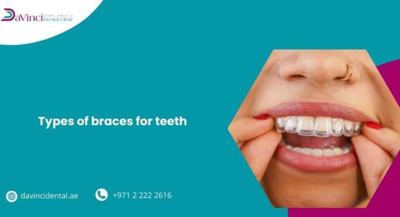 Types of Braces for Teeth