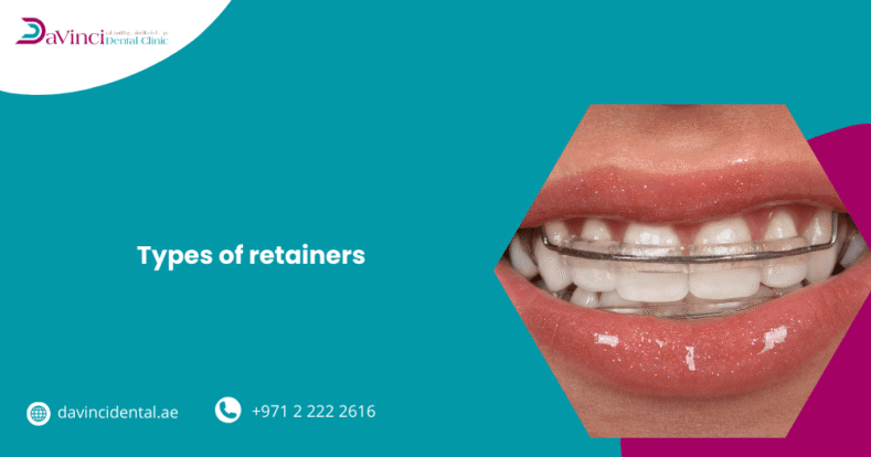 Types of Retainers