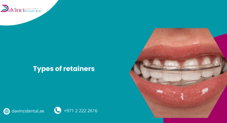Types of Retainers