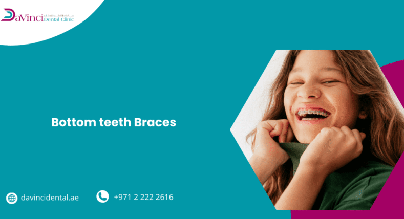 bottom teeth braces