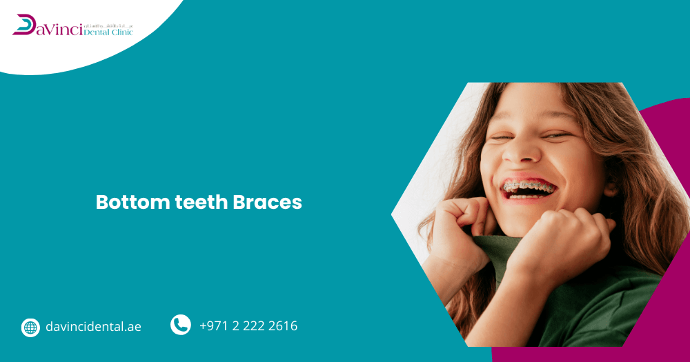 bottom teeth braces