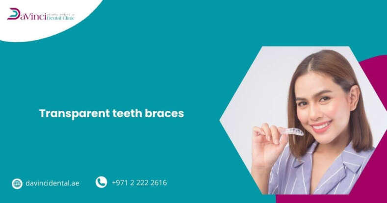 transparent teeth braces