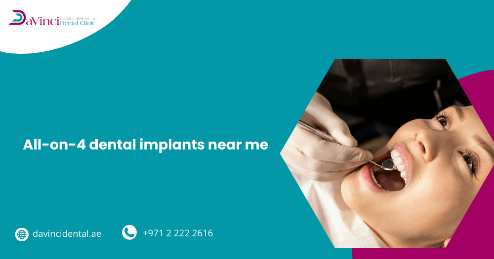 All-on-4 Dental Implants Near Me