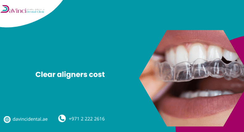 Clear Aligners Cost