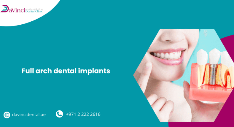 Full Arch Dental Implants