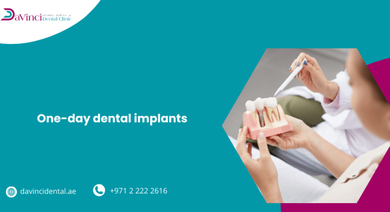 One-Day Dental Implants