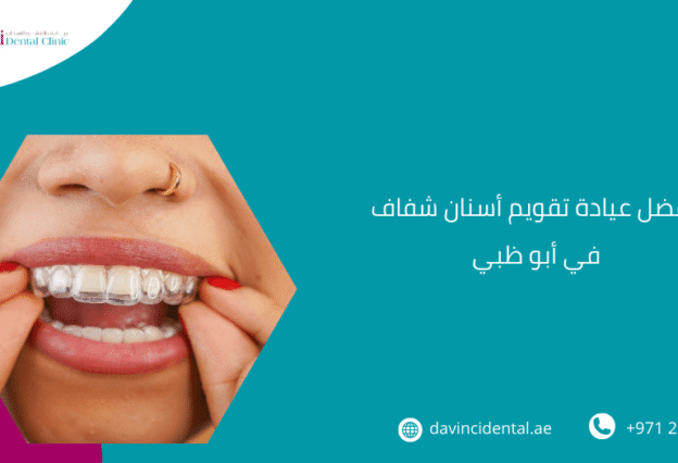 أفضل عيادة تقويم أسنان شفاف في أبو ظبي