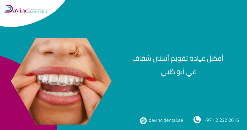 أفضل عيادة تقويم أسنان شفاف في أبو ظبي