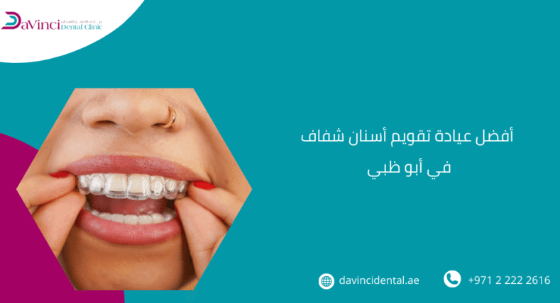 أفضل عيادة تقويم أسنان شفاف في أبو ظبي