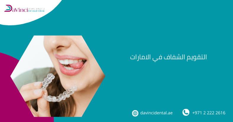 التقويم الشفاف في الامارات​