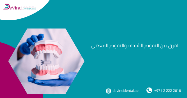 الفرق بين التقويم الشفاف والتقويم المعدني​