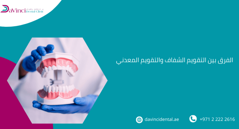 الفرق بين التقويم الشفاف والتقويم المعدني​