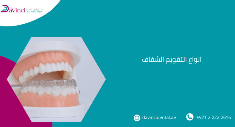 انواع التقويم الشفاف