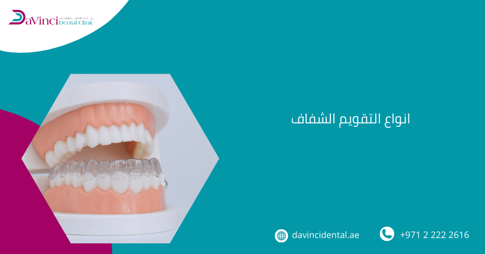 انواع التقويم الشفاف