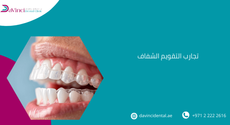 تجارب التقويم الشفاف