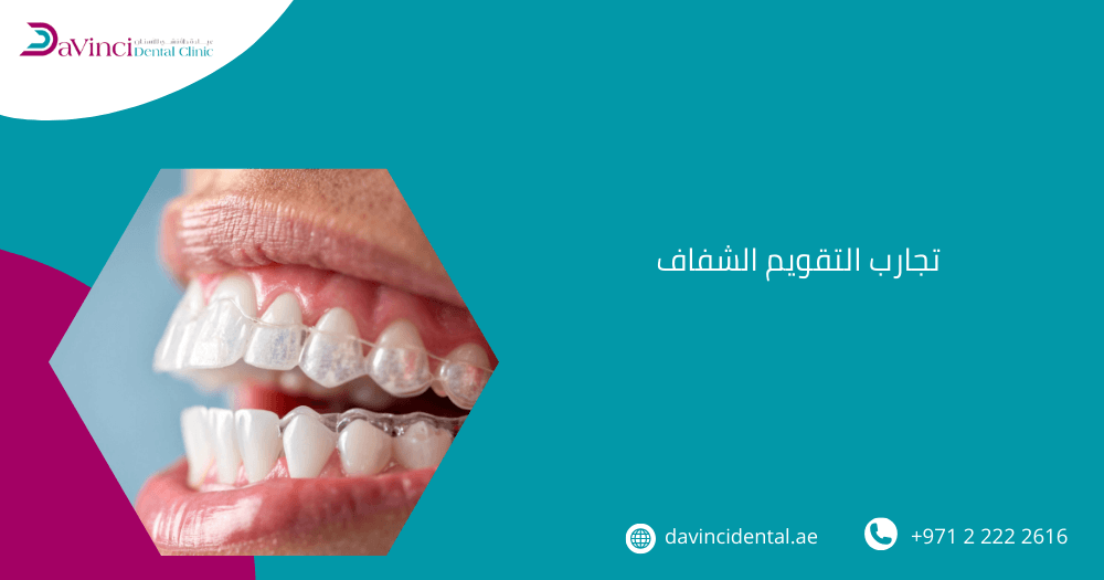 تجارب التقويم الشفاف