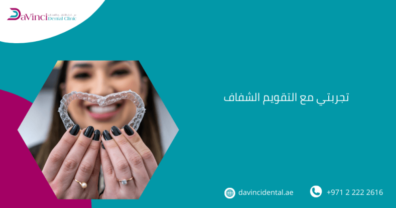 تجربتي مع التقويم الشفاف​