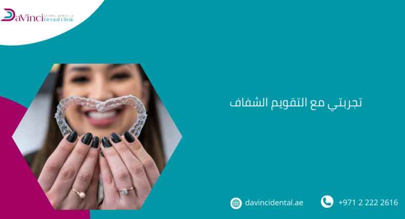 تجربتي مع التقويم الشفاف​