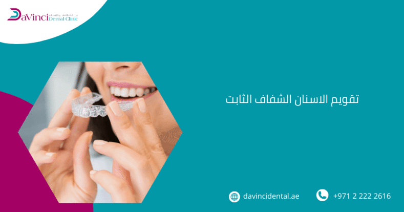 تقويم الاسنان الشفاف الثابت