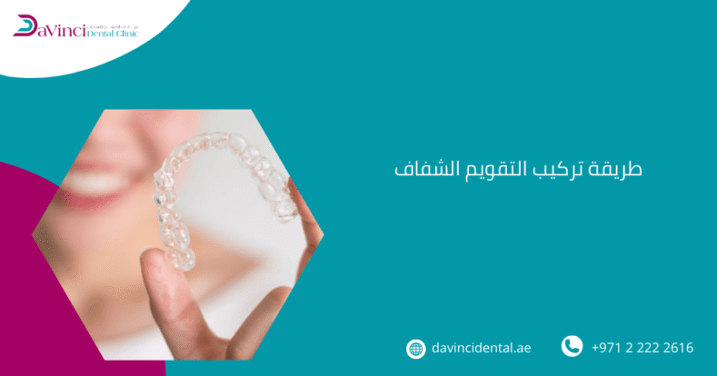 طريقة تركيب التقويم الشفاف​