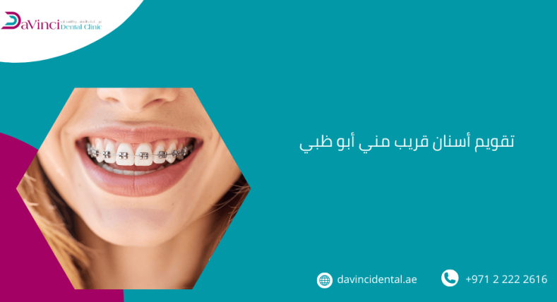 تقويم اسنان قريب مني ابو ظبي