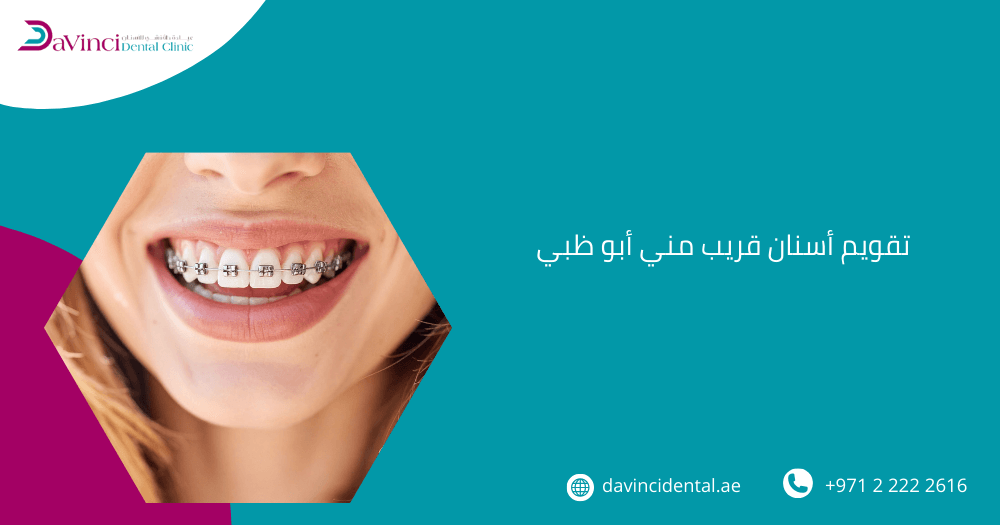 تقويم اسنان قريب مني ابو ظبي
