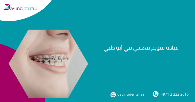 عيادة تقويم معدني في أبو ظبي